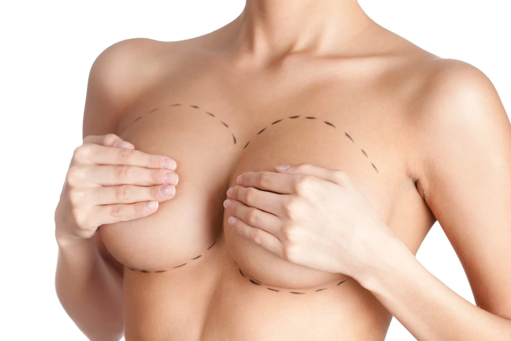 Αυξητική στήθους: Οι απαντήσεις στις 10 πιο hot ερωτήσεις (που σίγουρα έχεις στο μυαλό σου)