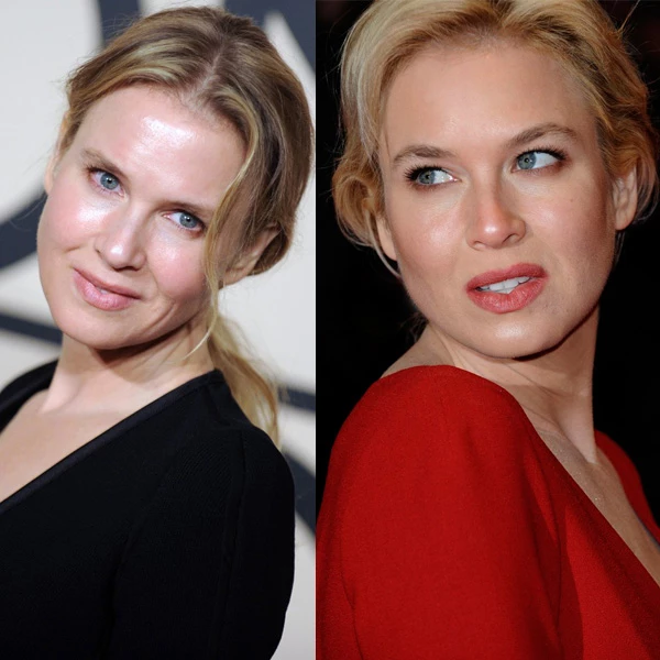 Renee Zellweger: Η απάντησή της στα επικριτικά σχόλια για την εμφάνισή της  - εικόνα 4