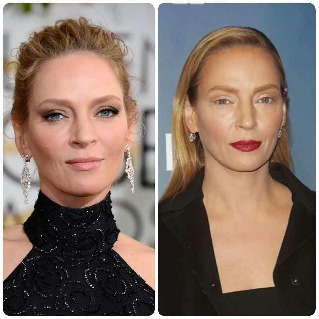 Η Uma Thurman απάντησε μετά το σάλο για το αλλαγμένο πρόσωπο της.